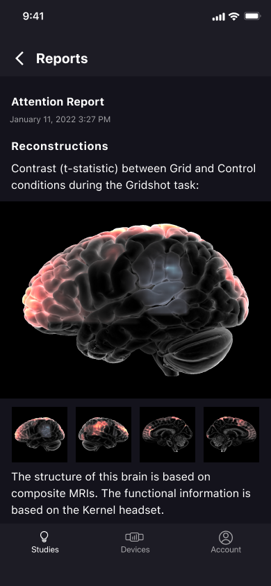 Kernel mobile report screen showing brain imagery and participant results